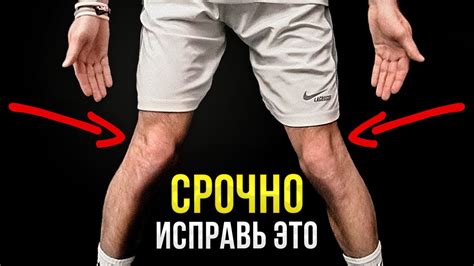 Чем опасны кривые ноги в коленях?