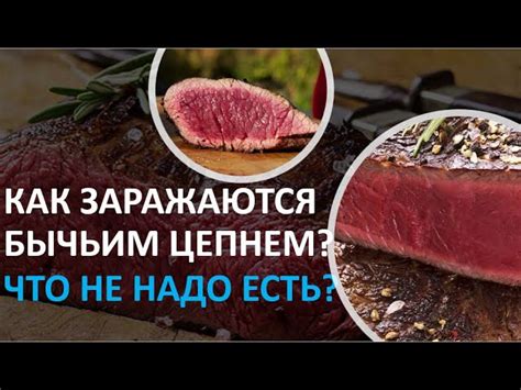 Что делать, чтобы избежать заражения бычьим цепнем?