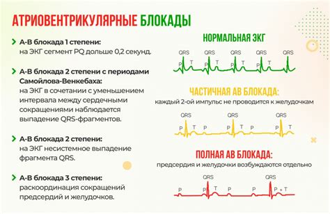 Что такое блокада на ЭКГ?