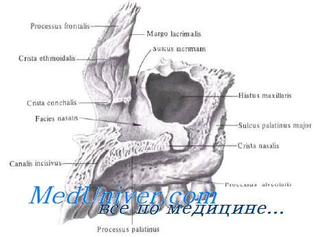 Что такое дефект медиальной стенки верхнечелюстной пазухи?