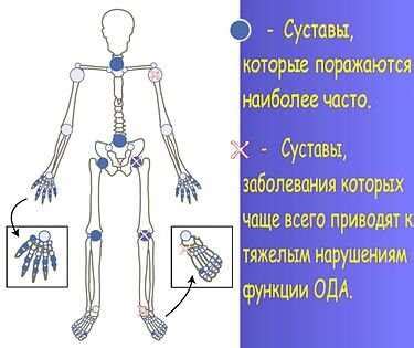 Что такое паравертебральные мягкие ткани?