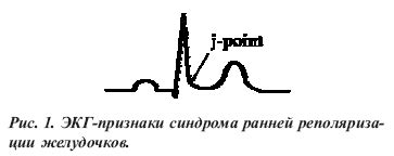 Что такое реполяризация желудочков