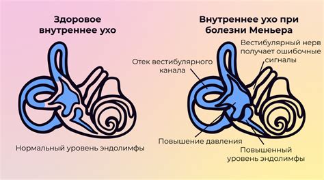 Что такое синдром потери времени