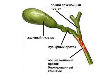 Что такое холедох и как он функционирует