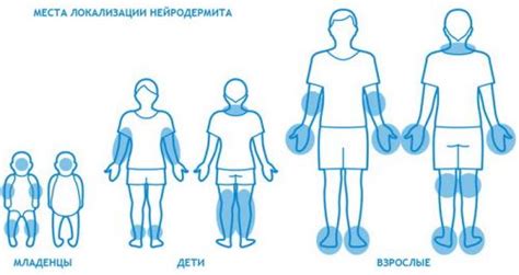 Шелушение на локтях: причины и способы избавления от проблемы