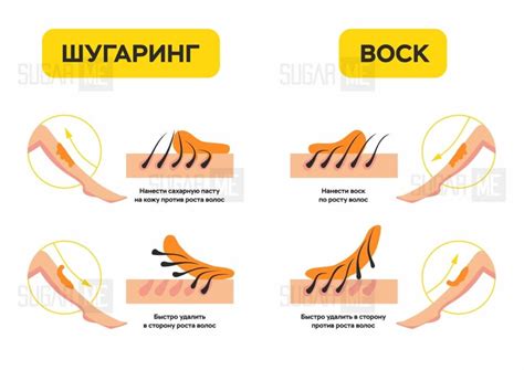 Шугаринг или крем: удобство и время