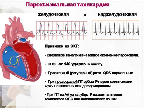 Эффективность Конкора при тахикардии