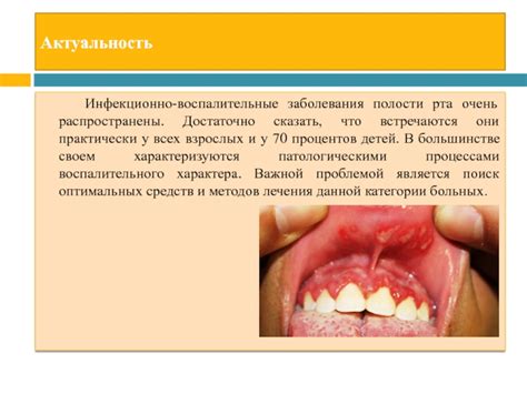 Эффективность препаратов при разных заболеваниях полости рта