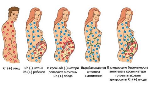  Какие последствия может иметь резус-конфликт для ребенка и матери? 