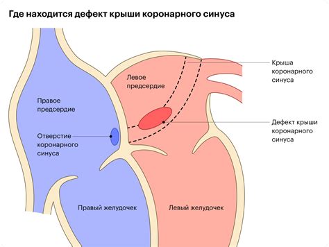  Кровь из левого глаза: что она может означать? 