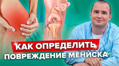  Менископатия коленного сустава: методы лечения 