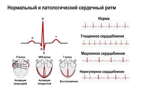  Сильное сердцебиение и быстрый пульс 